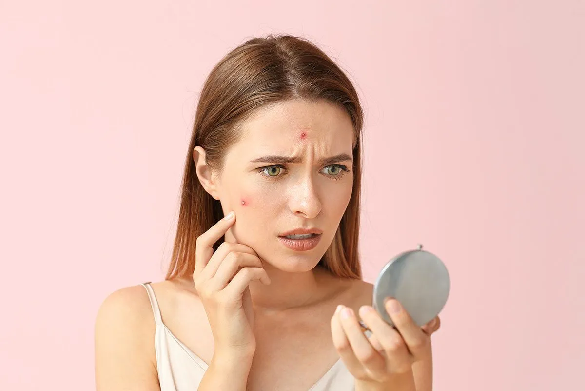 Transform Your Skin: The Best and Worst Foods for Acne